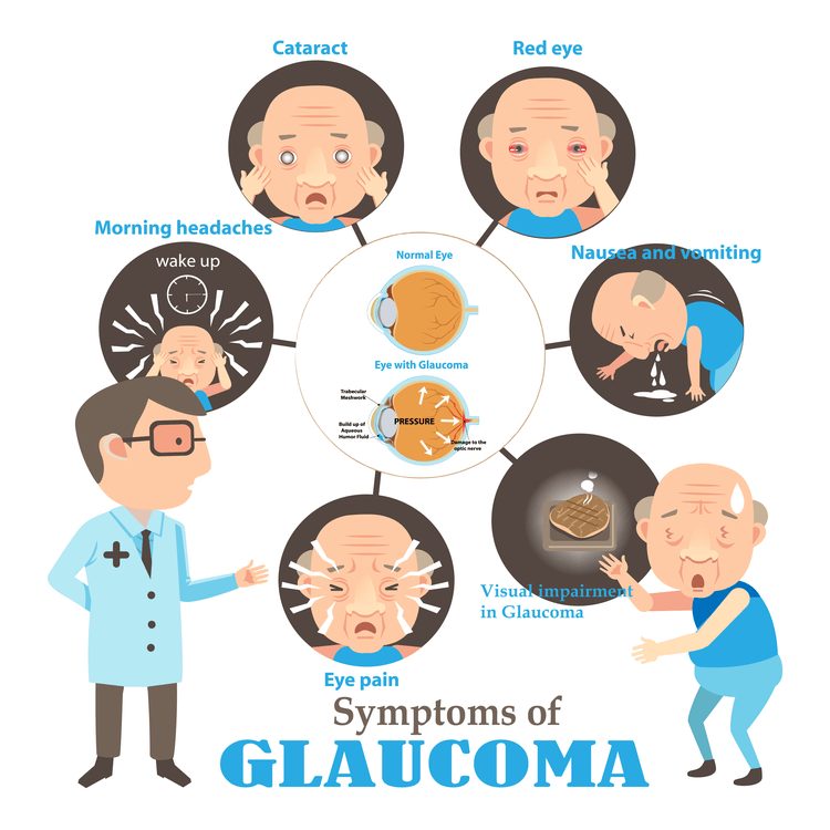 symptoms of glaucoma