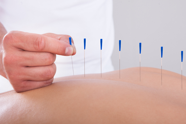 acupuncture therapy for ptsd