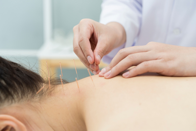 acupuncture, Natural Treatments for Lou Gehrig's Disease