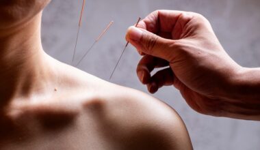 woman receiving acupunture