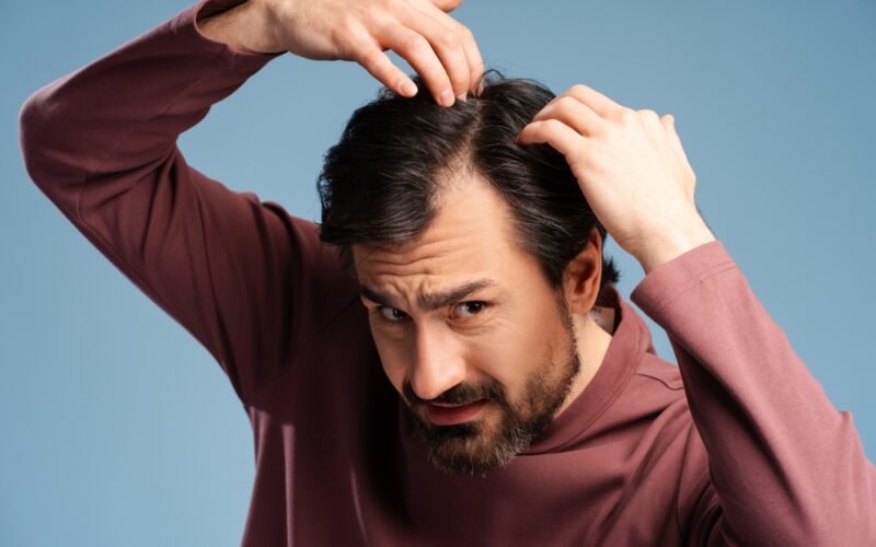 Man dealing with hair loss and showing his concern
