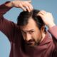 Man dealing with hair loss and showing his concern