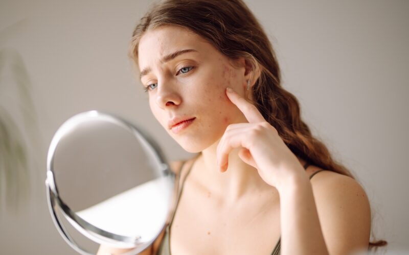 Woman looking at her skin and acne in a small mirror