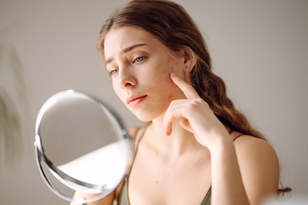 Woman looking at her skin and acne in a small mirror
