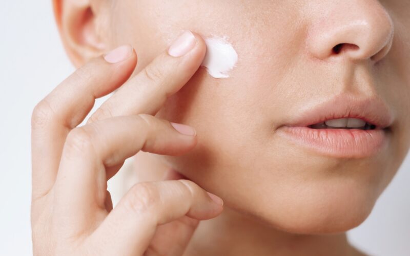 Woman applying Tretinoin into her skin to treat acne, wrinkles, and dark circles.